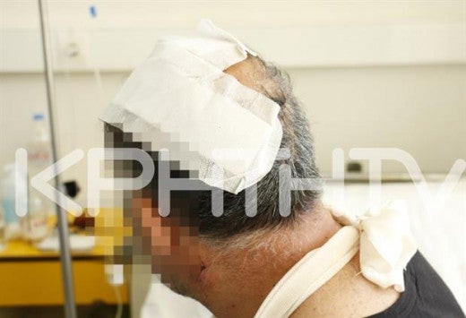 Κρήτη: Αυτός είναι ο πατέρας που βρέθηκε στα δόντια του πιτ μπουλ – 160 ράμματα μόνο στο κεφάλι (εικόνες,βίντεο)